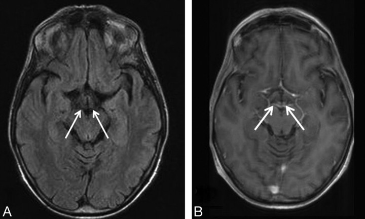 Fig 3.