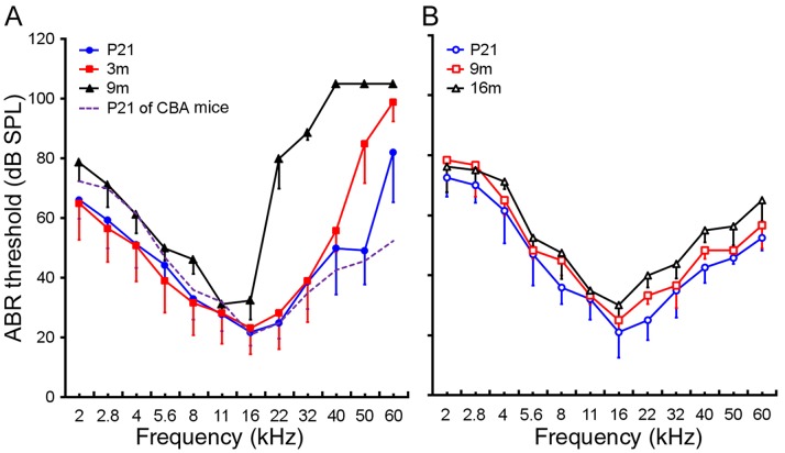 Identifying MicroRNAs Involved in Degeneration of the Organ of Corti ...