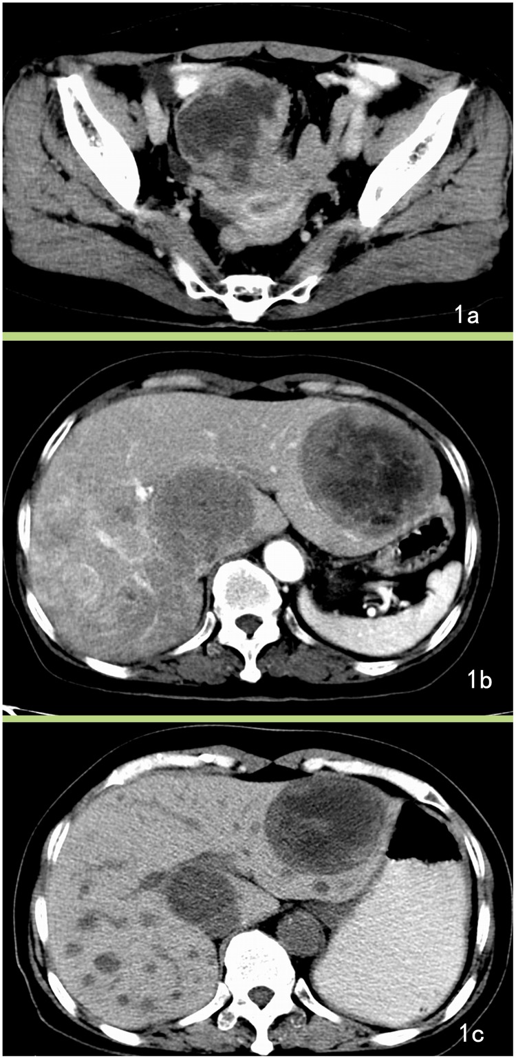 Fig 1