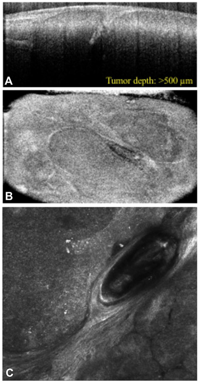 Fig 1.