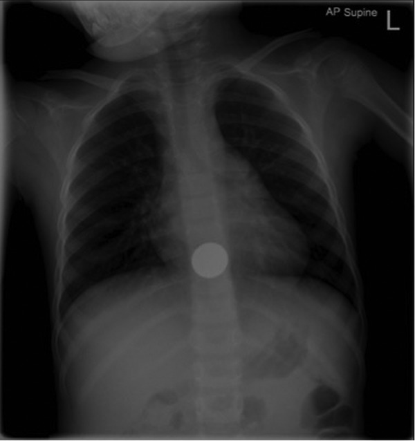 Figure 1