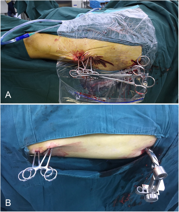 Fig. 7