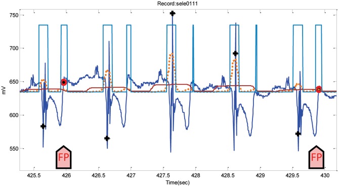 Figure 15