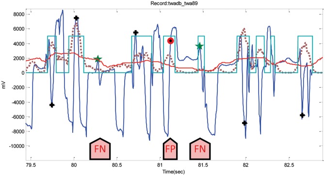 Figure 14