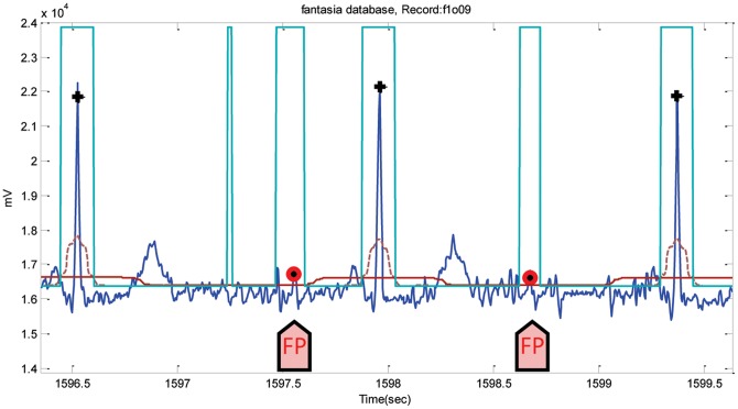 Figure 12