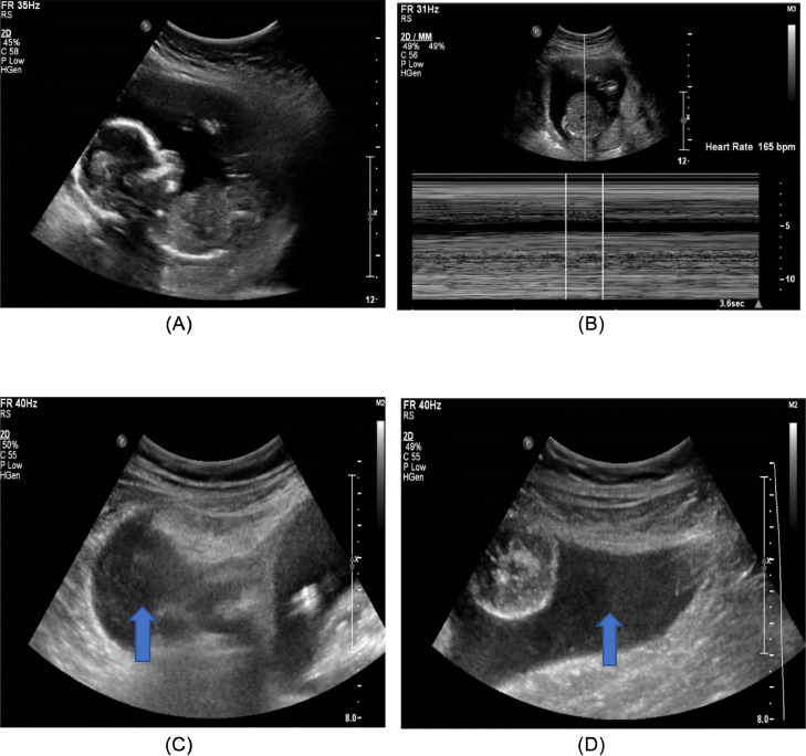Fig 2