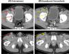 FIG. 4
