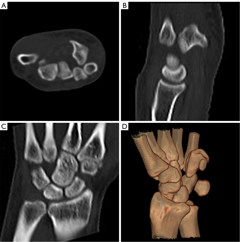 Figure 2