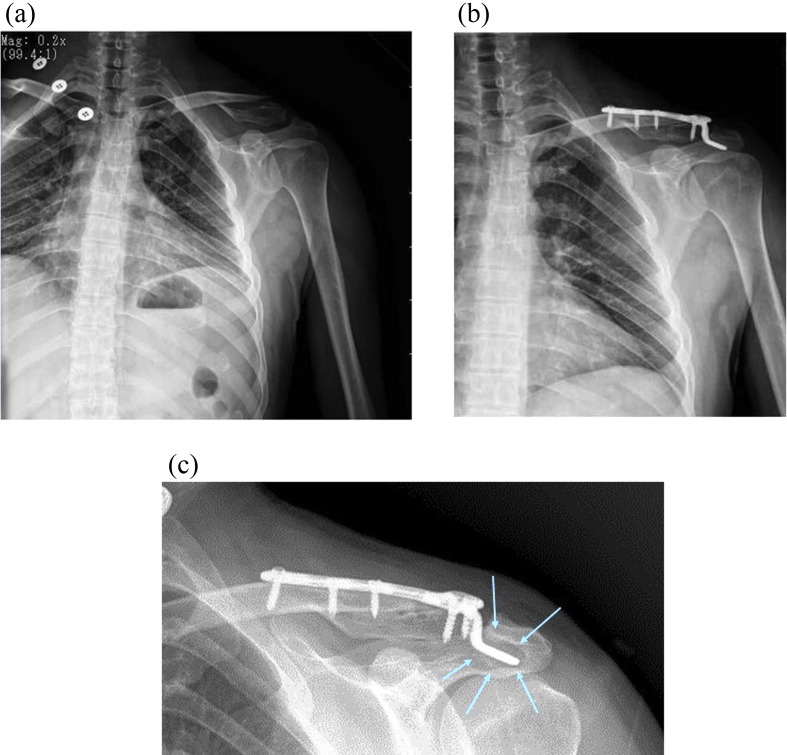 Fig. 1