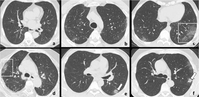 Fig. 5