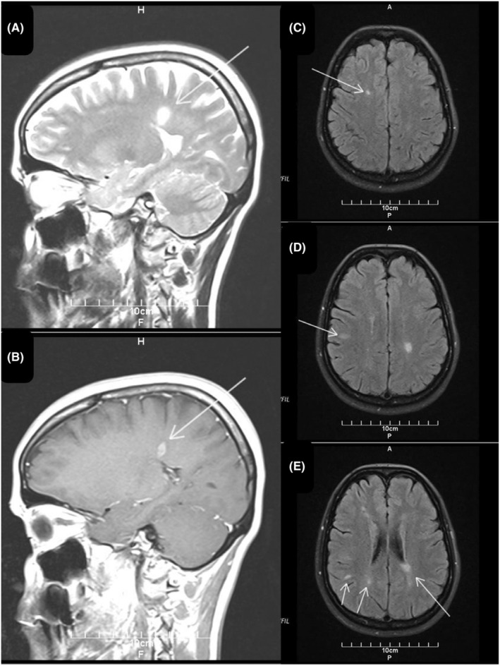 FIGURE 1