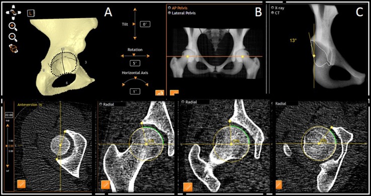 Fig. 1A–E