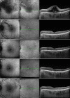 Fig. 3
