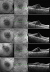 Fig. 4