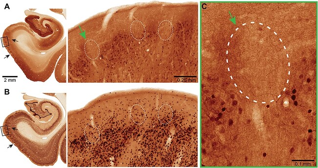 Fig. 12