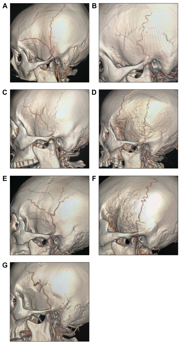 Figure 3.