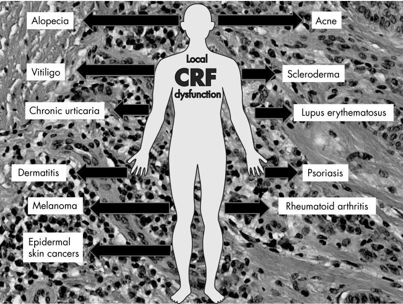 Figure 14.