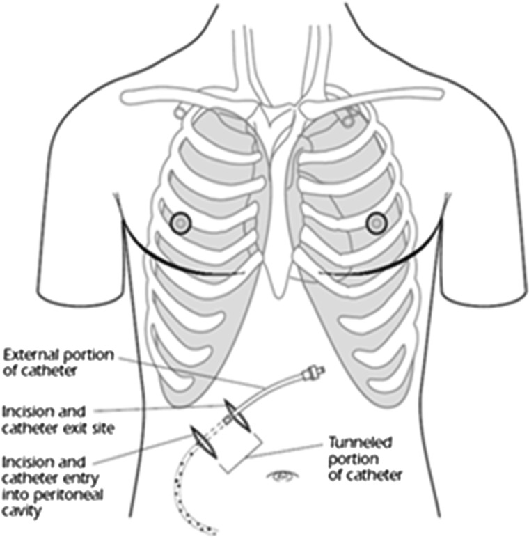 FIG. 3.