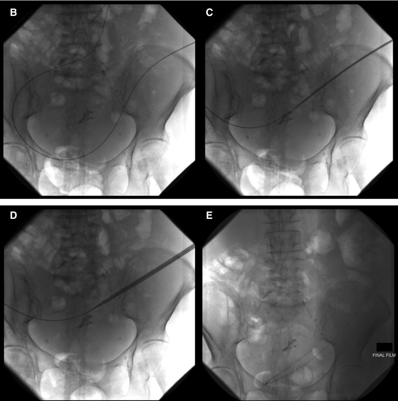 FIG. 2.