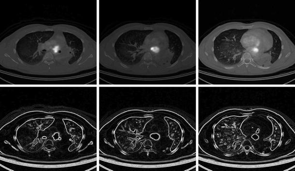 Fig. 18