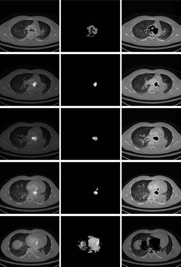 Fig. 17