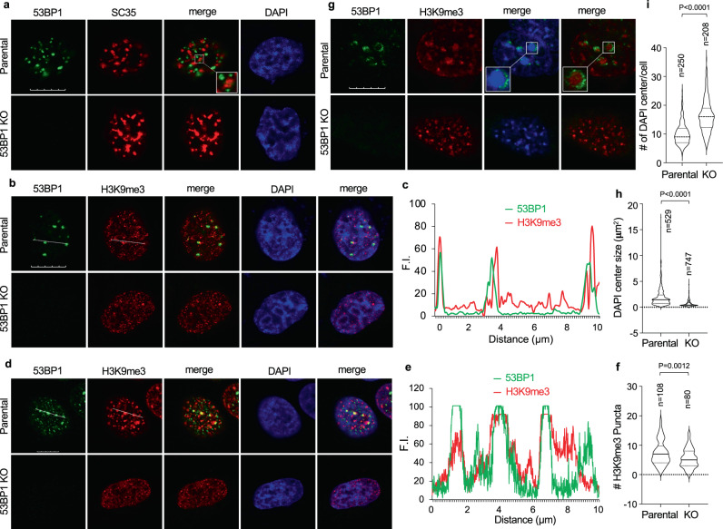 53BP1 regulates heterochromatin through liquid phase separation.