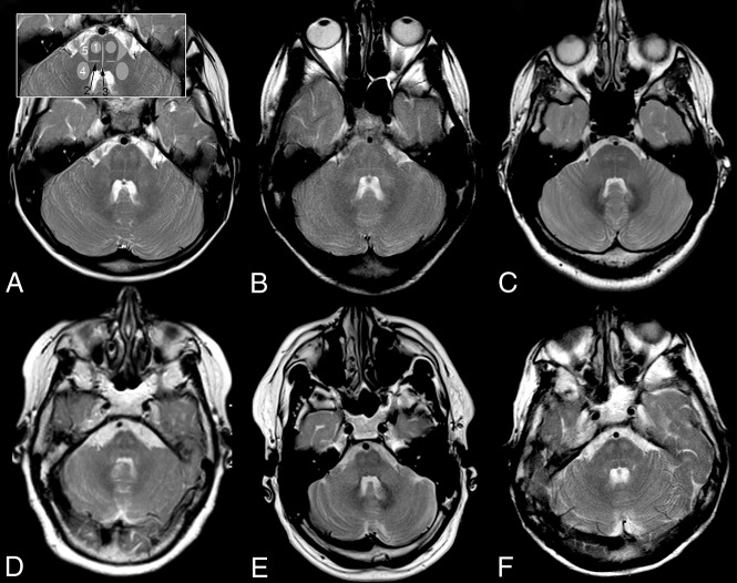 Fig 2.