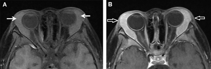 Fig 2 –