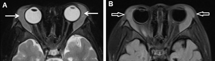 Fig 1 –