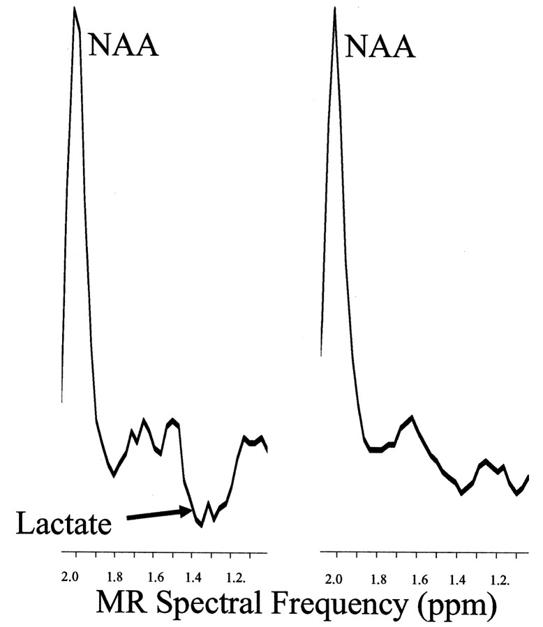 Fig 3.