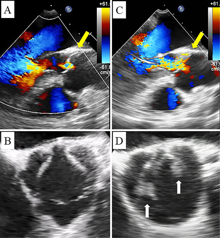 Figure 2.