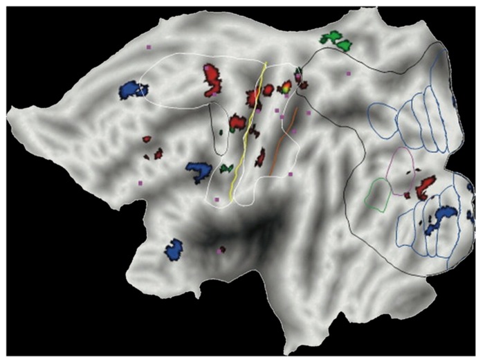 FIGURE 3