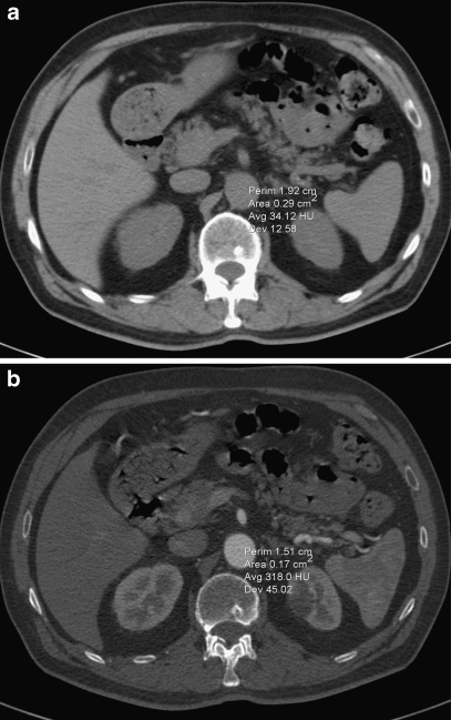 Fig. 1a, b