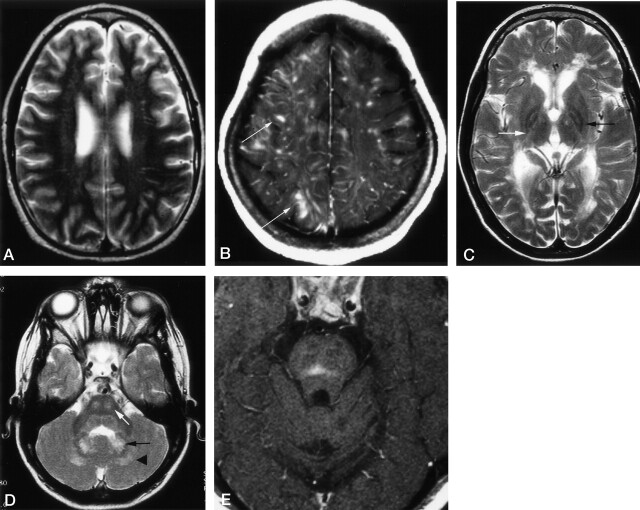 Fig 4.