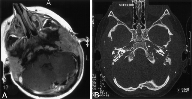 Fig 1.