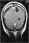 <i>Figure 1a</i>