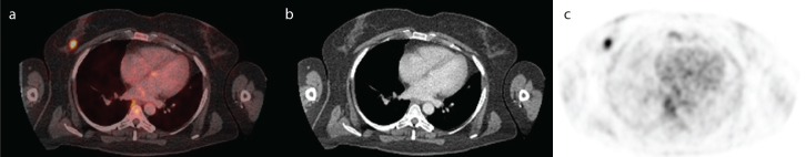 Figure 1. a–c