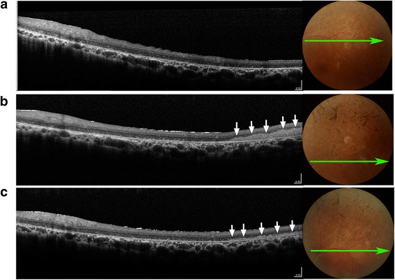 Fig. 3