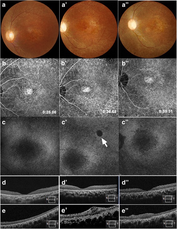 Fig. 4