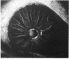 335