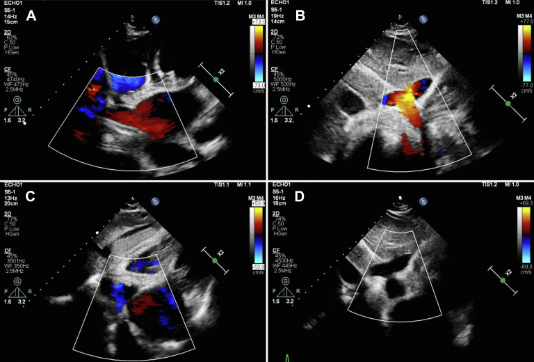 Figure 3