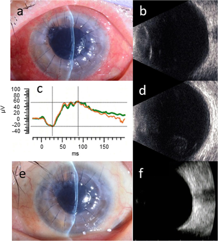 Fig. 4