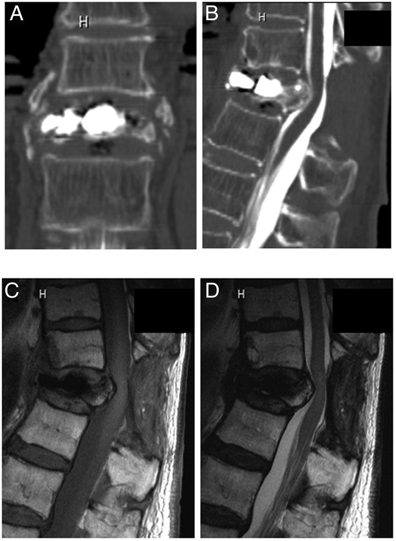 Figure 2