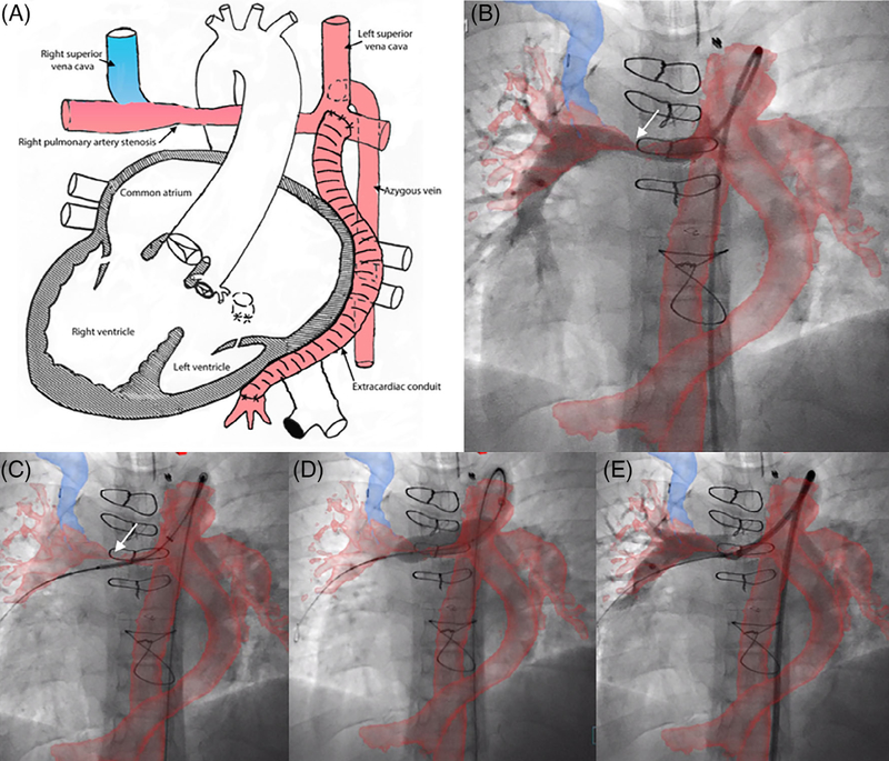 FIGURE 3