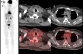 Figure1