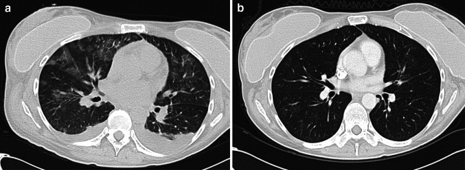 Fig. 4