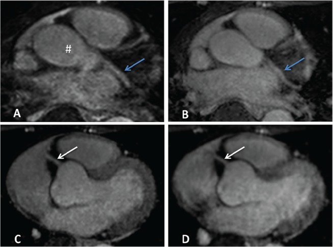 Fig 8.