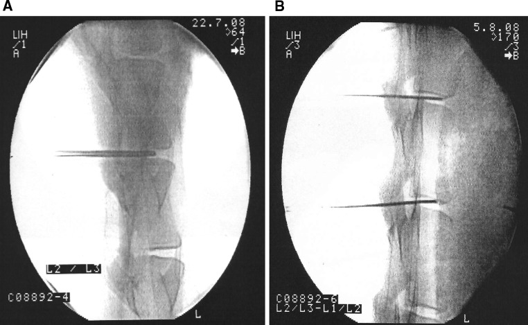 Fig. 1