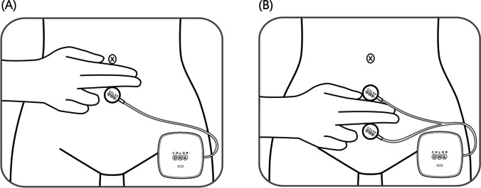 Fig. 2.