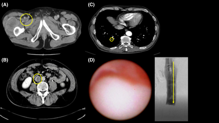 FIGURE 1